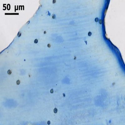 Proteoglycan staining